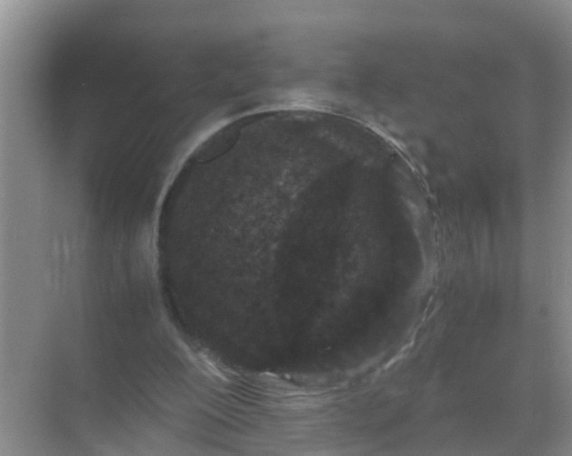 X0000071760200200607150011