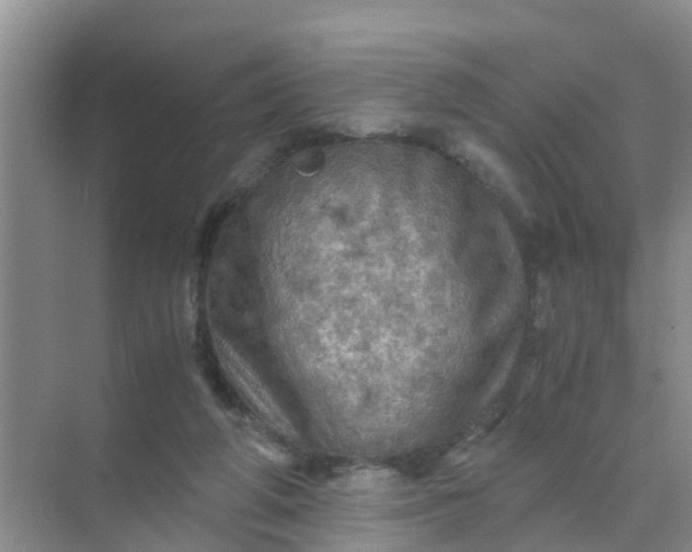 X0000071760210200607150011