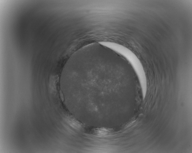 X0000071760229200607150010