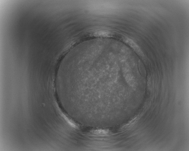 X0000071760449200607150006