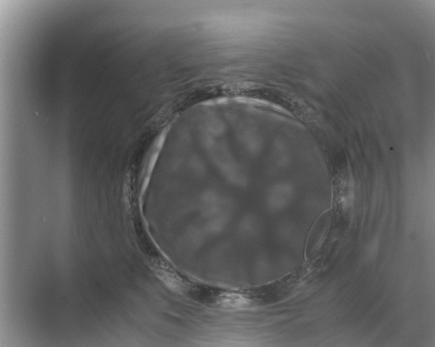 X0000071760519200607150006