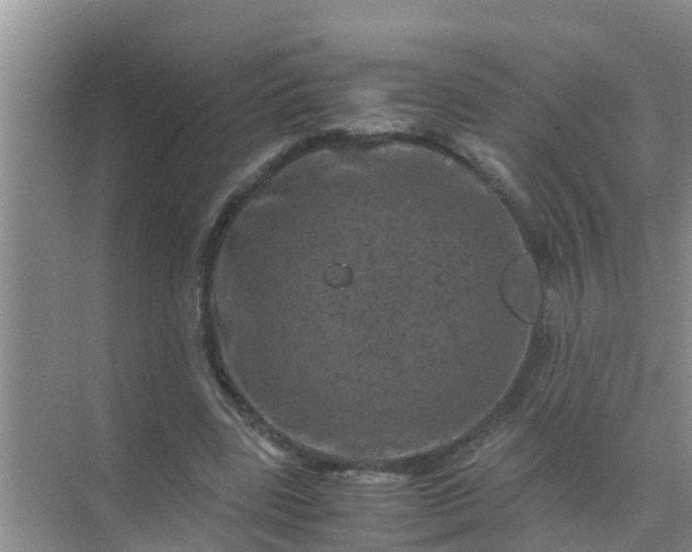 X0000071760539200607150005