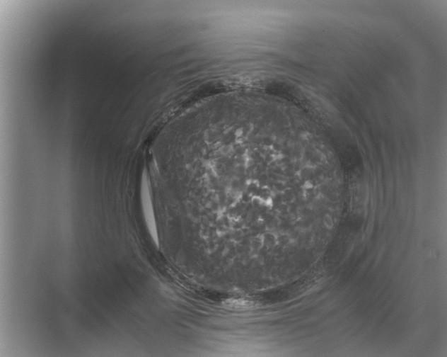 X0000071760699200607150002