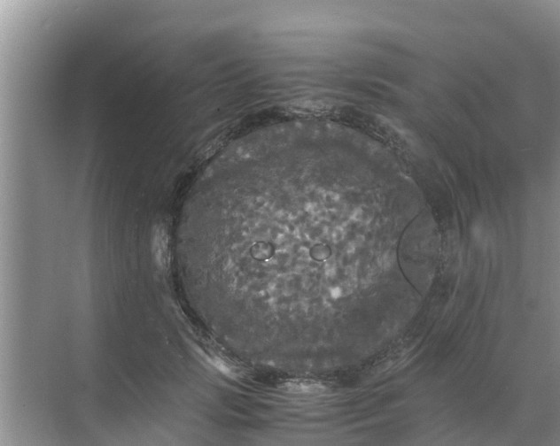 X0000071760749200607150002