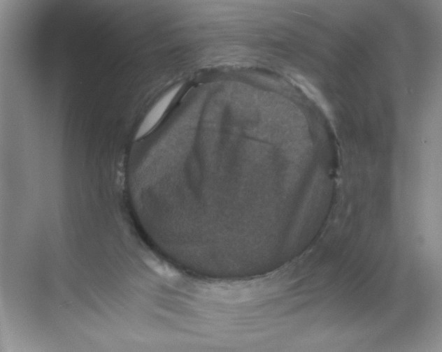 X0000071760017200607220021