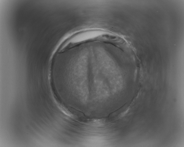 X0000071760056200607220020