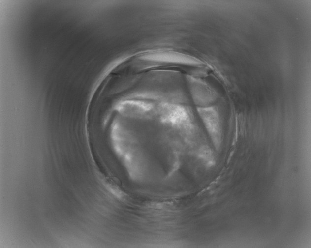 X0000071760147200607220018