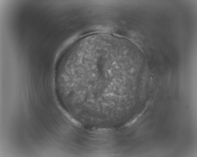 X0000071760149200607220018