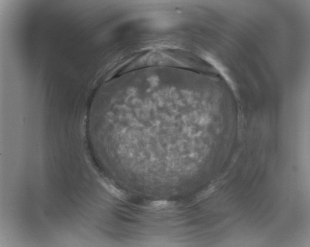 X0000071760153200607220019