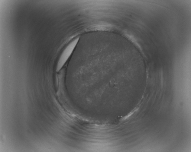 X0000071760154200607220019