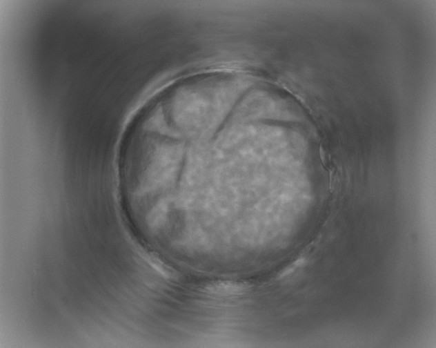 X0000071760198200607220018