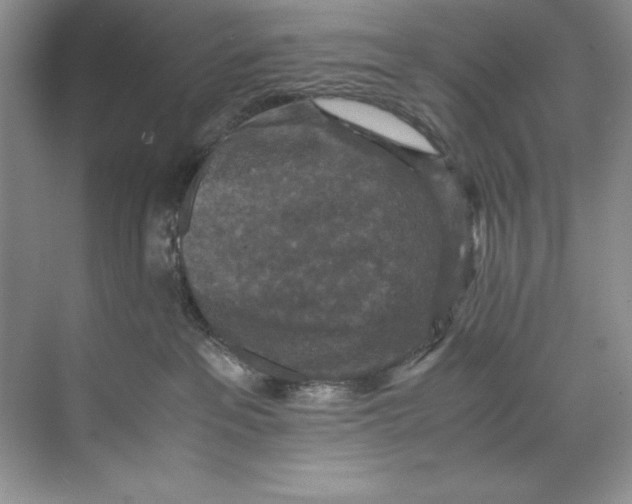 X0000071760237200607220018