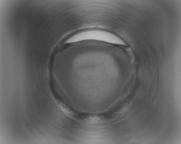 X0000071760256200607220017