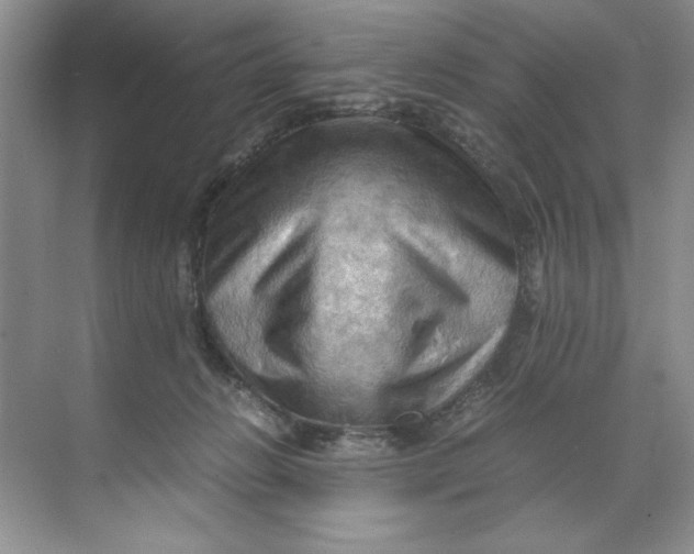 X0000071760270200607220017