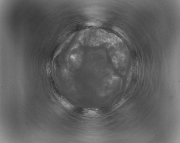 X0000071760285200607220018