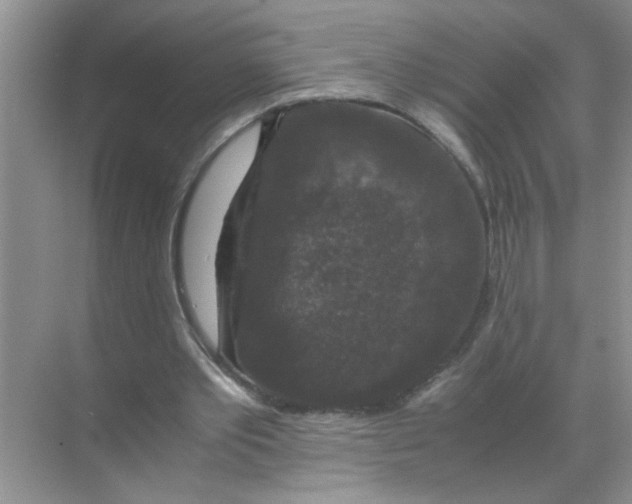 X0000071760389200607220015