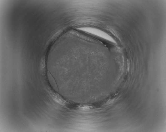 X0000071760407200607220015