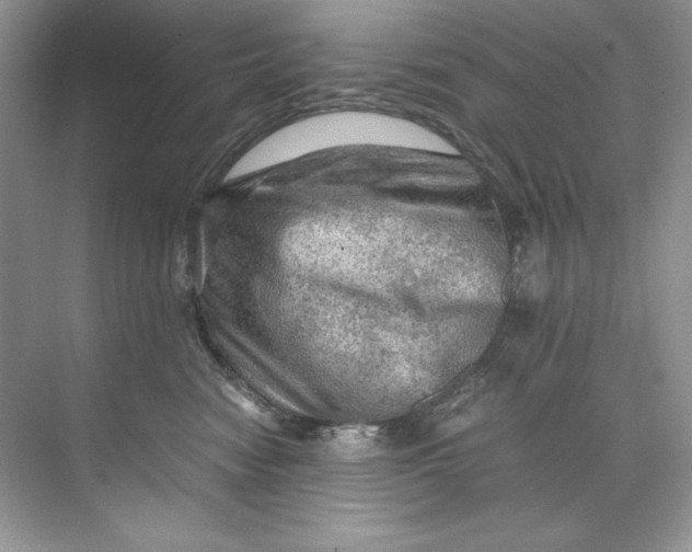 X0000071760474200607220014