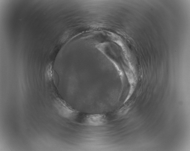 X0000071760479200607220014