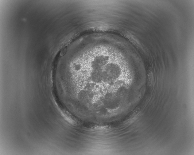 X0000071760638200607220011