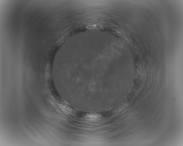 X0000071760659200607220011