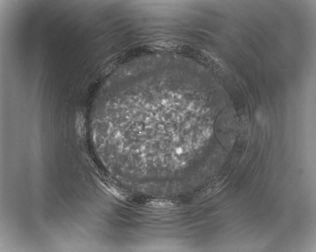 X0000071760749200607220009