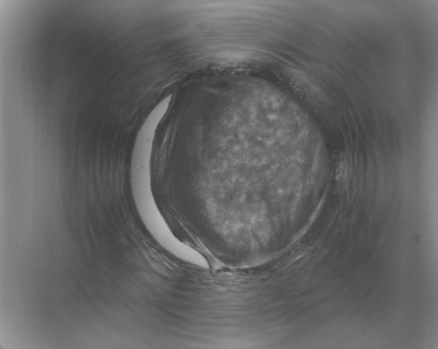 X0000071760868200607220007