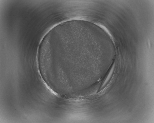 X0000071760910200607220006