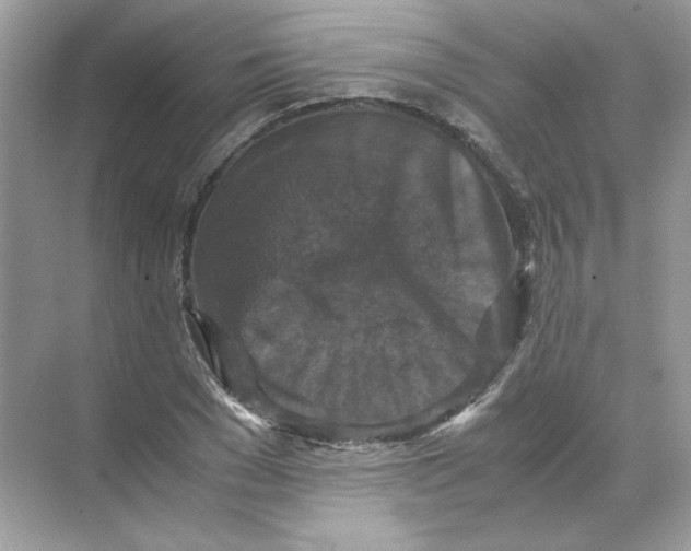 X0000071760977200607220005