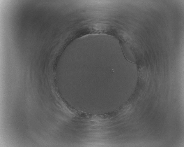 X0000071761009200607220004