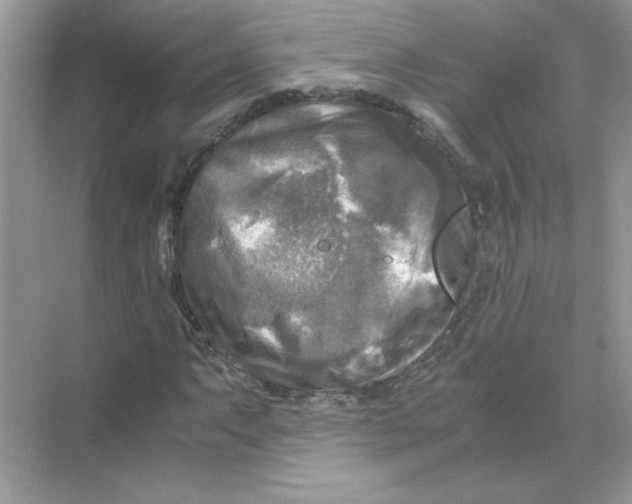 X0000071761063200607220004