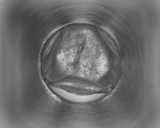 X0000071761133200607220003