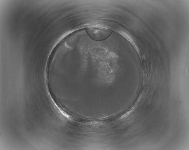 X0000071761141200607220003