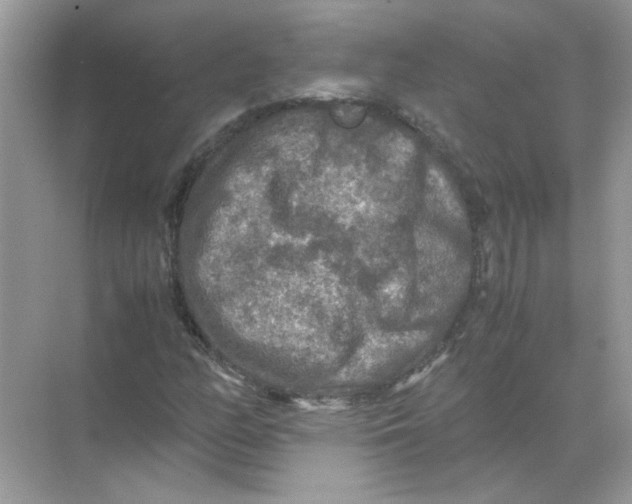 X0000071761158200607220002