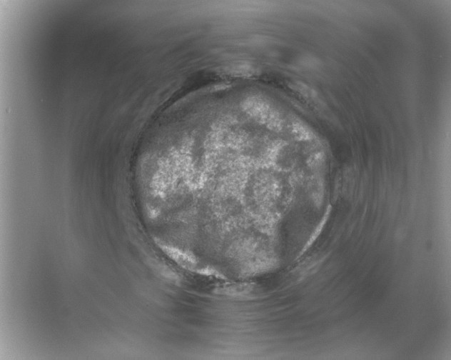 X0000071761201200607220001