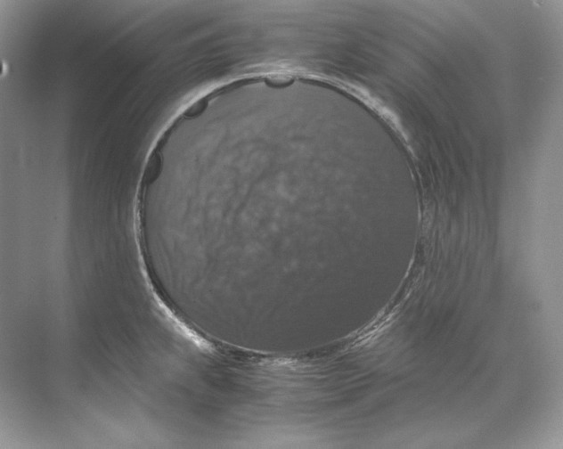 X0000071761239200607220001