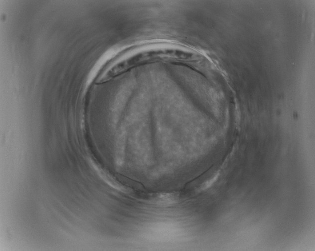 X0000071760056200607282158