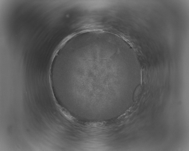 X0000071800147200606301210