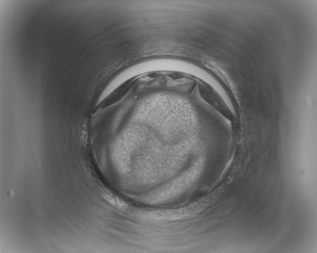 X0000071800017200607150158