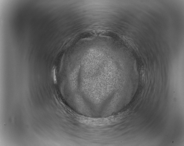 X0000071800042200607150158