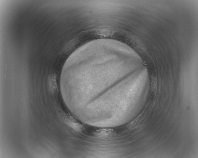 X0000071800128200607150156