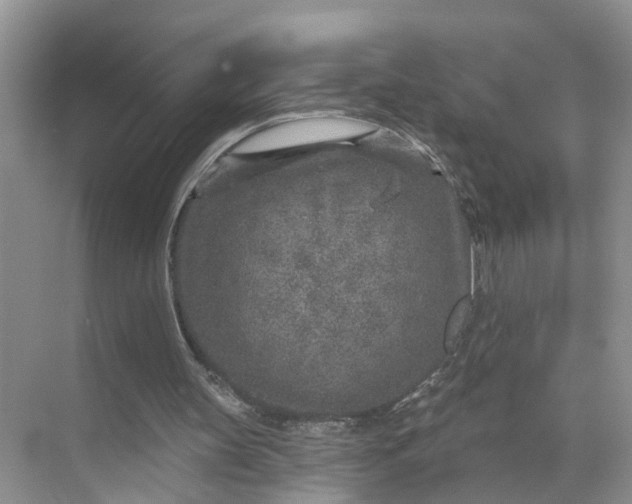 X0000071800147200607150155