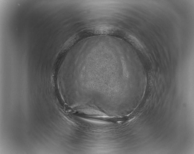 X0000071800258200607150154