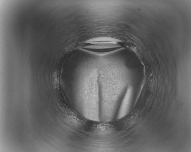 X0000071800420200607150151