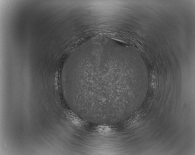 X0000071800519200607150150