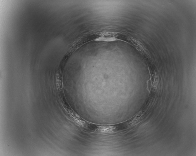 X0000071800569200607150150