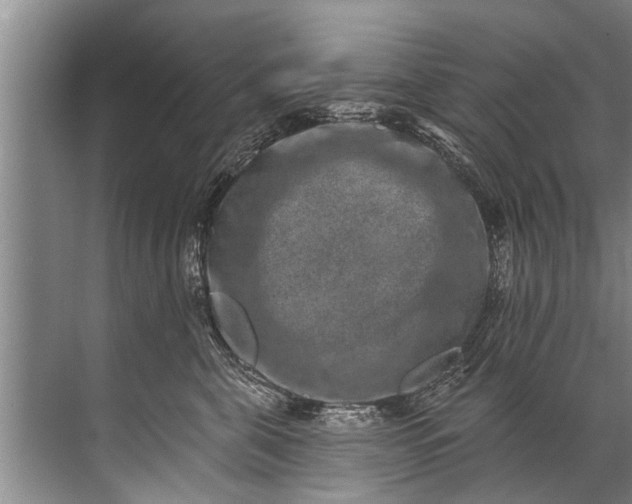 X0000071800571200607150150