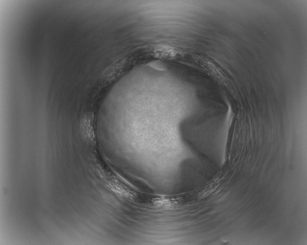 X0000071800616200607150148