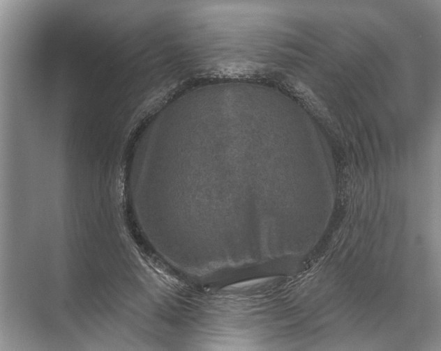 X0000071800640200607150147