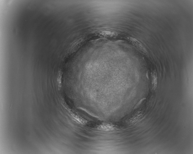 X0000071800668200607150148